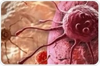 New breakthrough could modernize treatment for glioblastoma