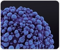 Advanced AI provides accurate guidance for prostate cancer patients