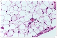 Turning Human Fat into Insulin-Producing Organoids That Reverse Diabetes