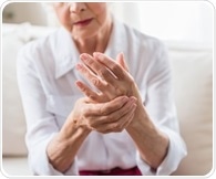 Arthritis significantly restricts employment for millions of American adults