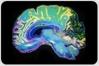 FDA-cleared ADHD device not effective in reducing symptoms