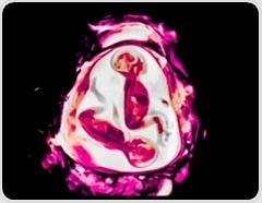 MRI scans reveal human brain growth from pregnancy through birth