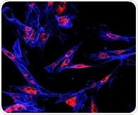 Researchers develop blood test to find pancreatic ductal adenocarcinoma