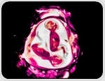 MRI scans reveal human brain growth from pregnancy through birth