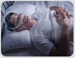Tirzepatide shows dual benefits in sleep apnea trial improving metabolism and reducing inflammation