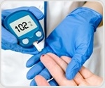 Diabetic nephropathy shows severe biochemical abnormalities