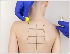 Top early-life factors driving childhood food allergy