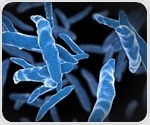 Study highlights systemic forces sustaining tuberculosis transmission