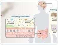 Researchers propose that Parkinson’s disease may start in the gut, not the brain