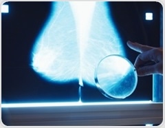 AI model flags hidden breast cancers years before diagnosis in routine mammograms