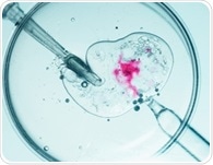 Fertility treatments linked to small increases in some cancers