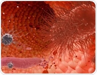 Why do some people respond better to GLP-1 drugs? Gut microbiome may hold clues