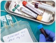 Blood protein structure changes may enable earlier detection of Alzheimer’s