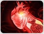 Gut-derived blood markers may help predict who develops coronary heart disease