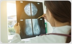 AI model achieves 99.24 % accuracy in breast ultrasound classification