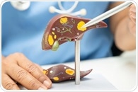 Palmatine improved fatty liver markers in a preclinical type 2 diabetes study
