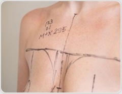 Breast reduction surgery is linked to lower diabetes and heart risk