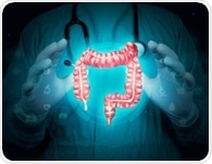 Chronic colitis reshapes colon stem cells in ways that can accelerate tumour growth