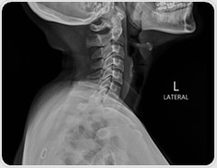 Study finds AI-generated X-rays can fool radiologists and chatbots