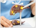 Palmatine improved fatty liver markers in a preclinical type 2 diabetes study