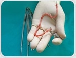 Regenerative vascular grafts solve key shortage in surgery