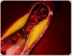 Evolocumab trial could reshape how doctors treat high-risk cholesterol patients