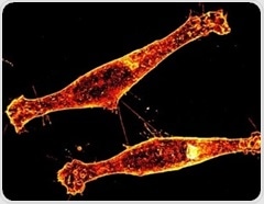 How toxic protein spreads in Huntington’s disease