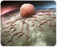 Ultrasound enables real-time monitoring and treatment of tumor vasculature