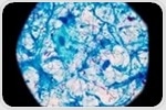 WHO urges faster TB detection with new point-of-care tests
