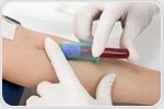 Novel screening method boosts early diagnosis of leprosy