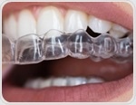 Cola may quickly lower pH inside orthodontic clear aligners and shift oral bacteria within hours