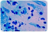 Two new TB vaccines show safety but limited protection