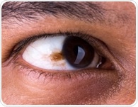 Semen-derived exosomes eye drops to treat retinoblastoma