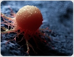 New blood test spots four cancers and other diseases by stripping away healthy DNA noise