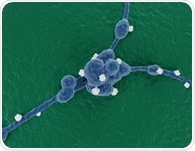 Targeted diet helps reprogram aggressive neuroblastoma in mice