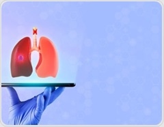 Lab study shows cigarette smoke damaged lung cells more than e-cigarette vapor