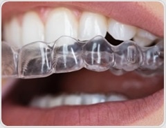 Cola may quickly lower pH inside orthodontic clear aligners and shift oral bacteria within hours