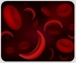Study identifies intersectional biases affecting care for sickle cell patients