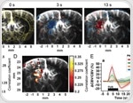 Functional ultrasound (fUS) vs. focused ultrasound (FUS) for brain activity mapping