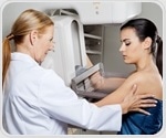 ACP recommends biennial mammography for women aged 50 to 74