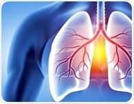 Understanding periostin as a biomarker in allergic diseases