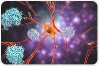 Alzheimer’s monoclonal antibodies fail to deliver meaningful results