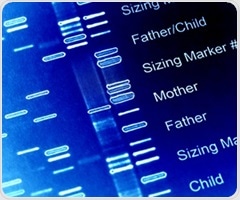 Key gene variants tied to developmental dysplasia of the hip and osteoarthritis