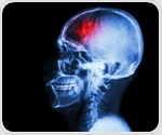 Scientists identify genes linked to human intelligence