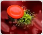 Study finds different types of crystalloid fluids are equally effective for pediatric sepsis