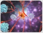 Alzheimer’s monoclonal antibodies fail to deliver meaningful results