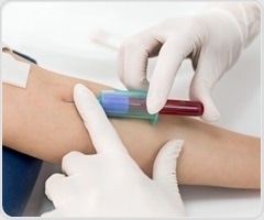 New blood-based method identifies testicular cancer missed by standard tests