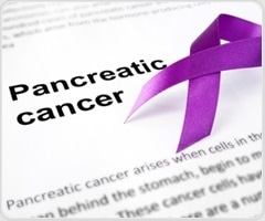 AI model detects pancreatic cancer years before clinical diagnosis