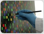 Lipid pathways driving diabetes and heart disease risk in South Asians