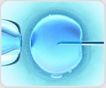 Uterine fibroids may be less common in Latina women than previously estimated